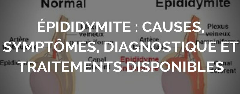 epididymite-causes-symptomes-diagnostique-et-traitements-disponibles